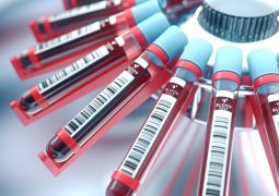 Lab equipment centrifuging blood. Concept image of a blood test.3d rendering.Lab equipment centrifuging blood. Concept image of a blood test.3d rendering.