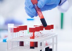 Collection of Autoimmune Diseases